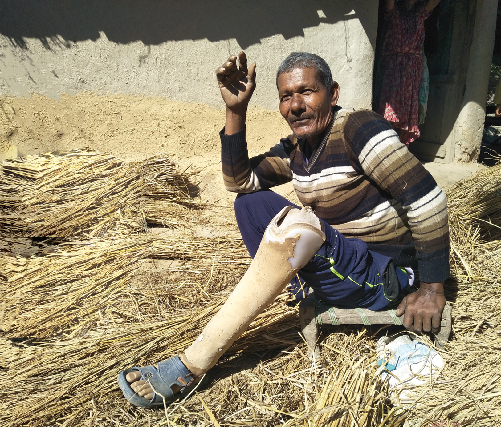 A man seated on straw with a prosthetic leg